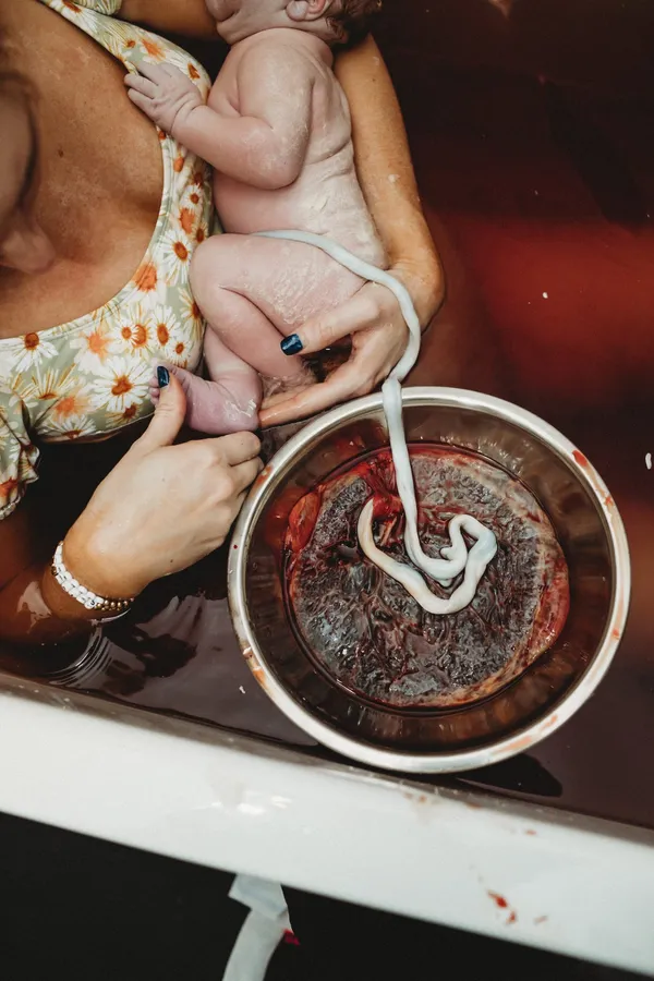 Placenta Encapsulation